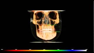 iCat Flex Demo Video