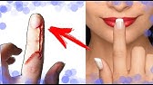 Как избавиться от заусениц | Простой метод - YouTube