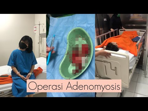 Video: Operasi 