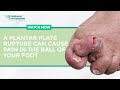 A Plantar Plate Rupture Can Cause Pain in the Ball of Your Foot