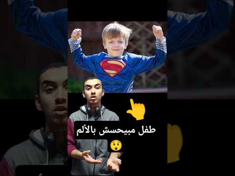 طفل مبيحسش بالألم