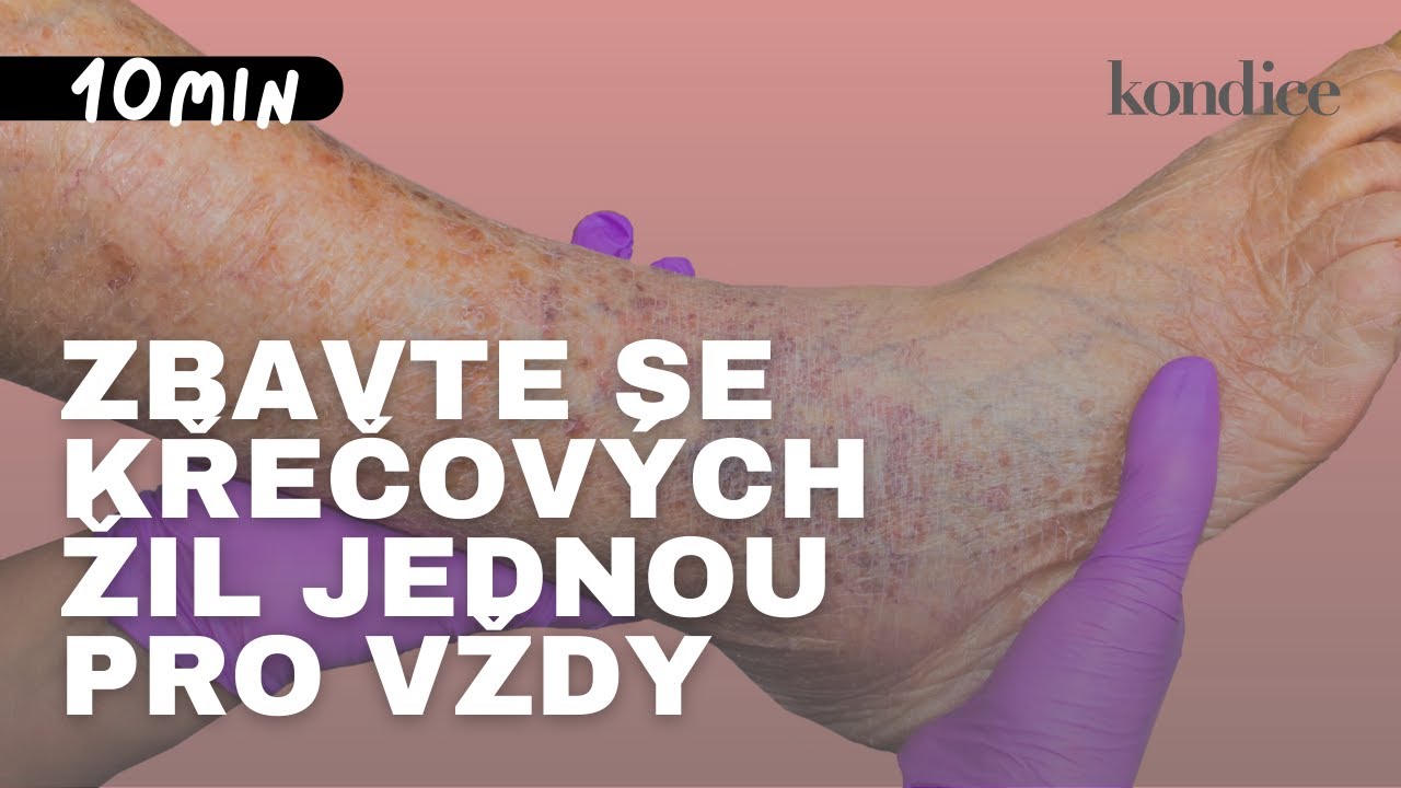 Cvičení na doma: Úleva od křečových žil