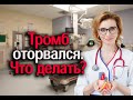 Тромб оторвался. Что делать? Кардиолог. Москва.