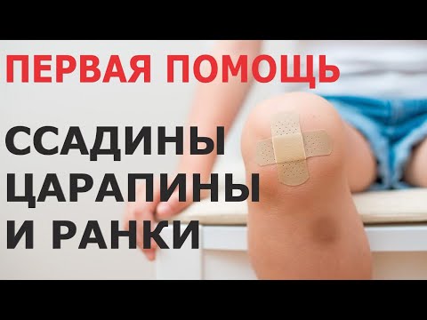 Чем лечить ссадины на улице ребёнку. Чем промыть, обеззаразить и заклеить.