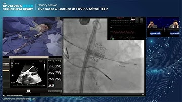 [AP VALVES & SH 2023] Live Case & Lecture 4: TAVR & Mitral TEER