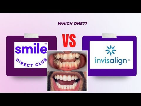 Smile Direct Club VS Invisalign | My Bad Experience