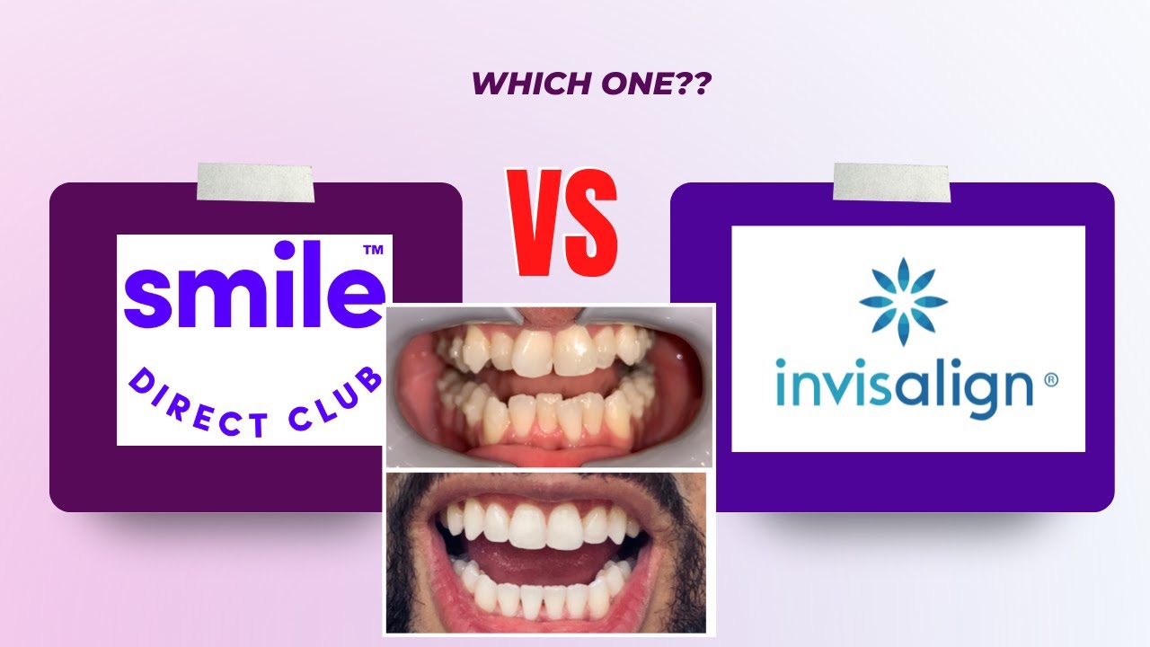 Invisalign Vs Braces: Which One Is Better?