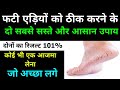 फटी एड़ियों से परेशान हो ।। Crack Heal ।। फटी एड़ियों का घरेलू उपाय ।। Faizu Ki Tips