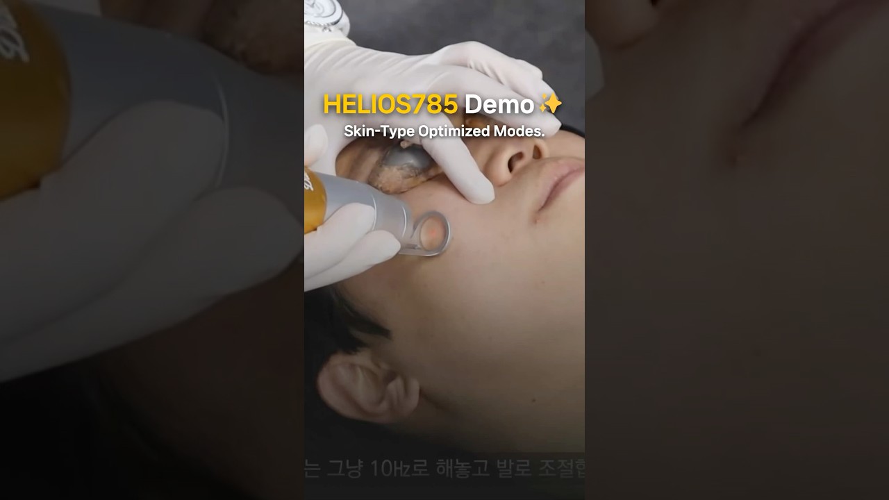 Clinical Pearl: Pigmentation Protocol with HELIOS 785