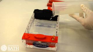 Agarose Gel Electrophoresis of DNA fragments amplified using PCR