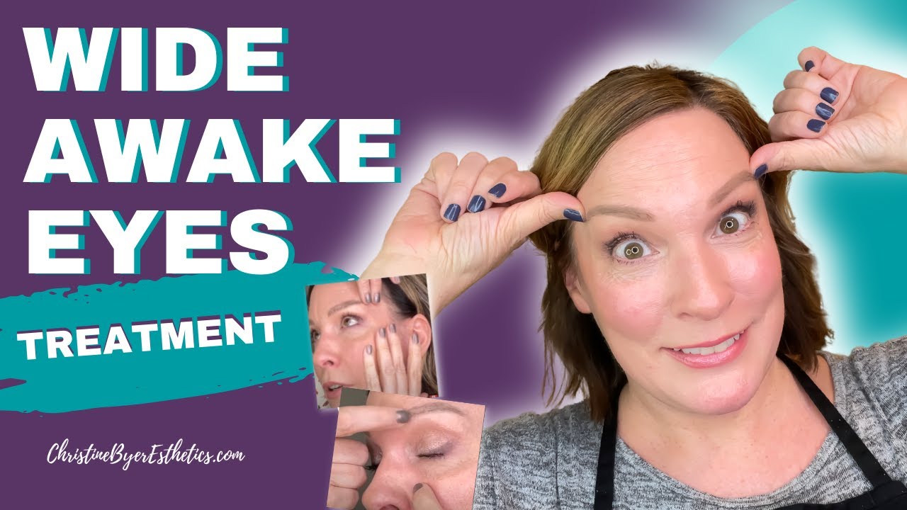 BIGGER, more AWAKE looking eyes