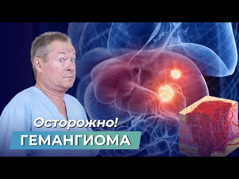 Осторожно! Нужно ли УДАЛЯТЬ ГЕМАНГИОМУ?