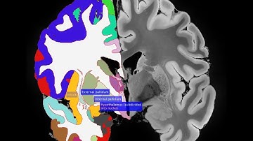 100-micron MRI scan with labeled hemisphere and ROI names (coronal)