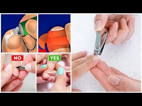 Βίντεο: Αποτελεσματικοί τρόποι πλύσης πράσινων υλικών από το δέρμα και τα νύχια (συμπεριλαμβανομένης της ανεμοβλογιάς)