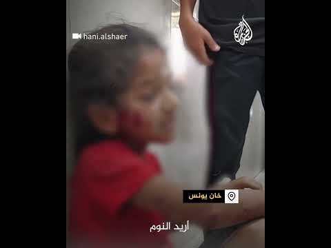 طفلة تصرخ بعد إصابتها: أريد النوم.. لا أتحمل