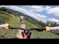 First Time Downhill Mountain Biking Since My ACCIDENT!