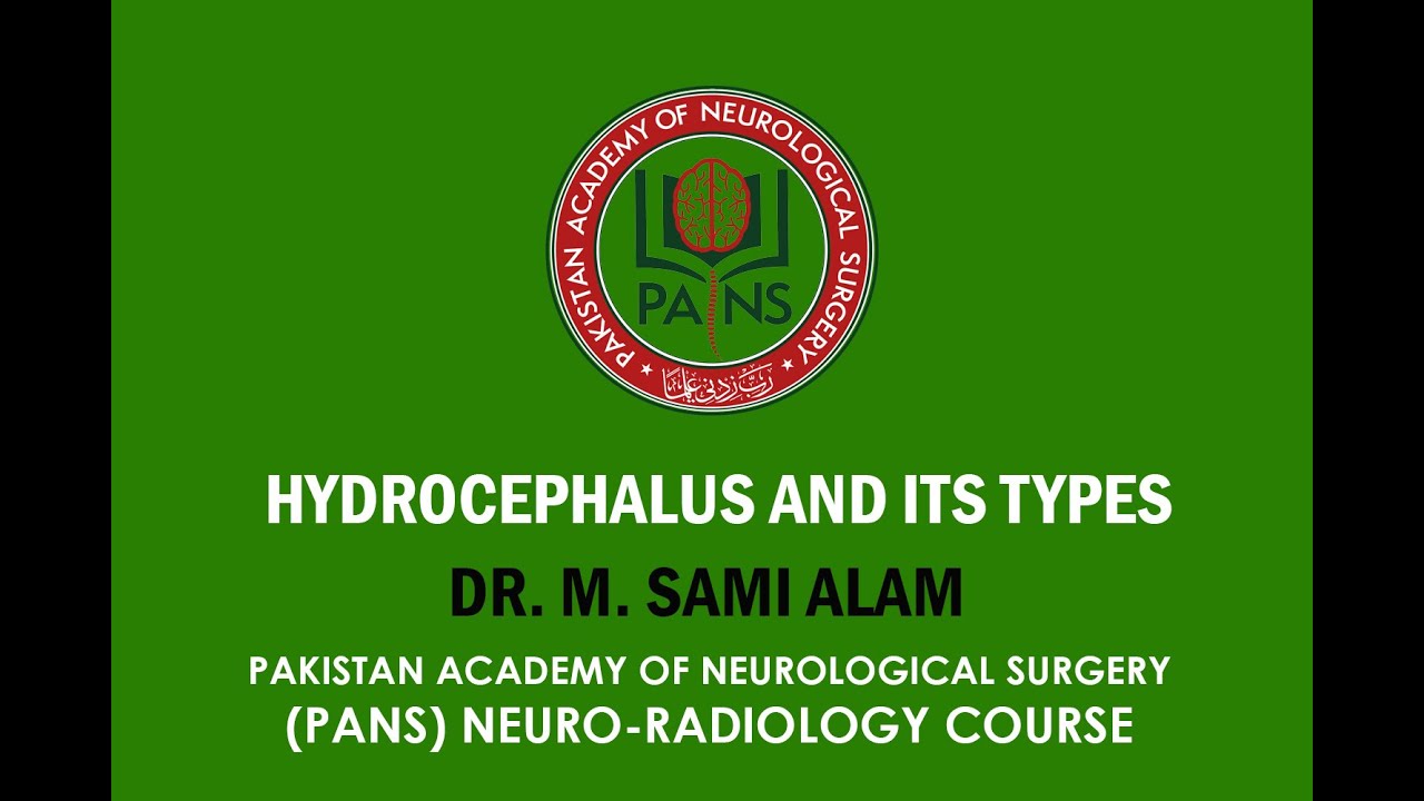 Hydrocephalus and its types by Dr. M. Sami Alam | PANS