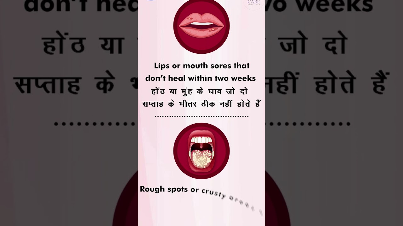 Recognize the Signs: Early Detection of Mouth Cancer