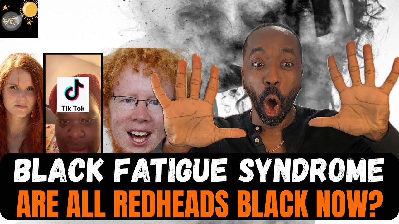 Black fatigue syndrome , open for all disagreements !!