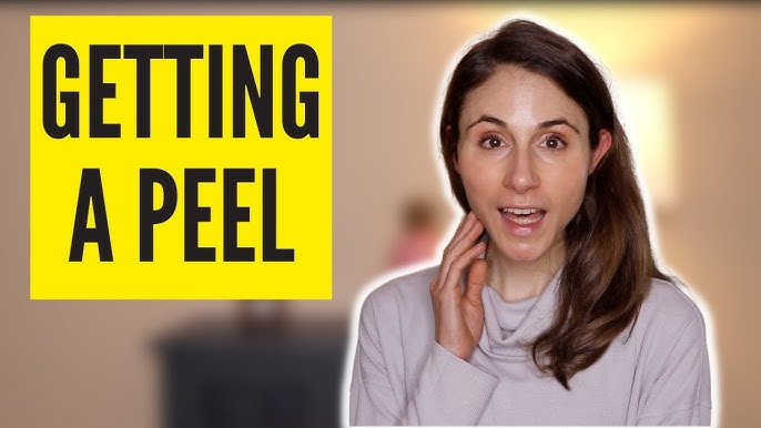 Meaning of Peeling in LoL and Guide on How to Peel