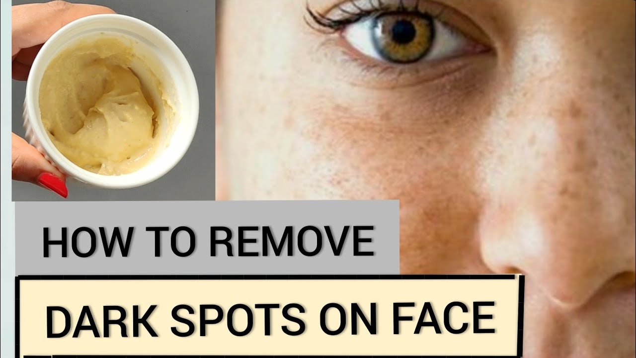 DIY PACK FOR PIGMENTATION, DISCOLORATION,SUNBURN,DARK SPOTS | 100%