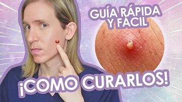 ¿Cómo hacer que salga el pus de un grano interno?