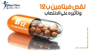 فيتامين ب 12 وتأثيره على الانتصاب - دكتور علاء عجلان - علاء كلينيك - 504
