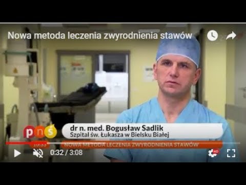Wideo: Skuteczność Wysokocząsteczkowego Kwasu Hialuronowego W Chorobie Zwyrodnieniowej Stawu Kolanowego U Pacjentów W Wieku Produkcyjnym: Randomizowane Badanie Kontrolowane