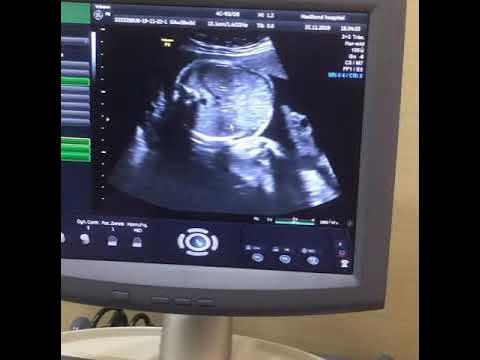 Chiroyli frantsuz jinsiy aloqa