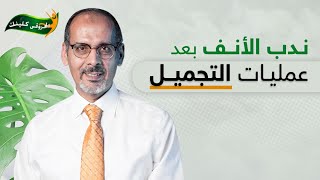 ندب الانف بعد عمليات تجميل الانف | دكتور محمد المحروقي