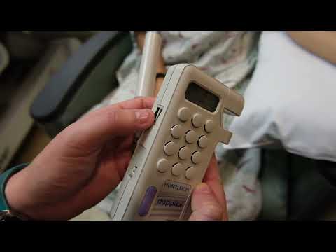 Doppler Blood Pressure on a Patient with a Ventricular Assist Device