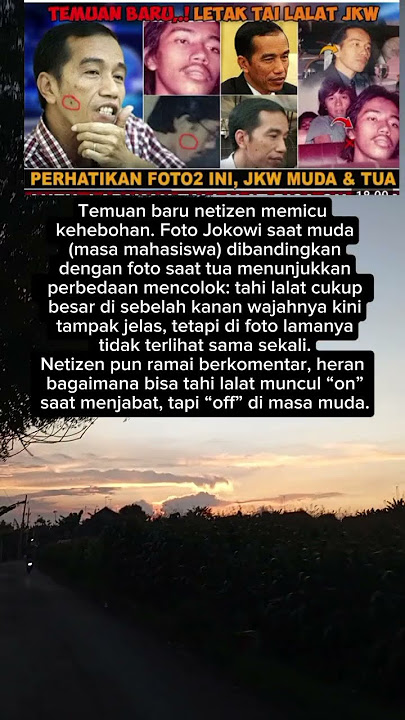 “Netizen Heboh: Tahi Lalat Jokowi Bisa ‘On-Off’?”#shorts