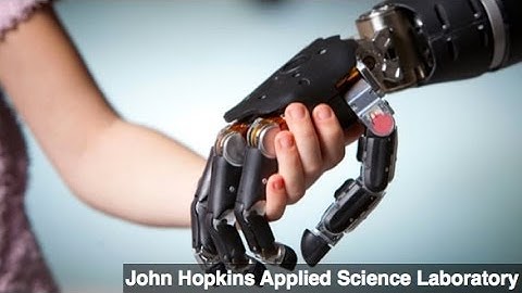 New Prosthetic Limb Provides Sense of Touch