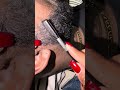 Beard Dandruff Scratching