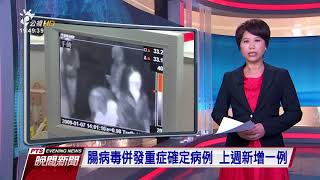 腸病毒併發重症確定病例 上週新增一例 2017 0829 公視晚間新聞