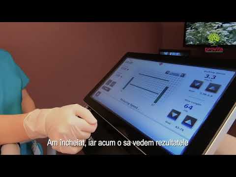 Video: Reglarea Automată Versus Manual A Instruirii Mersului Asistat De Robot La Persoanele Cu Tulburări Neurologice