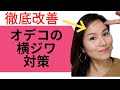 【オデコの横ジワ徹底改善】原因と対策