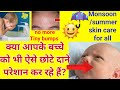 ☀️Summer skin care tips|☔️मानसून में Baby Skin केयर कैसे करें| चेहरे पर छोटे छोटे दाने हटाने के उपाय