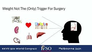 ANZMOSS Session: Public Bariatrics