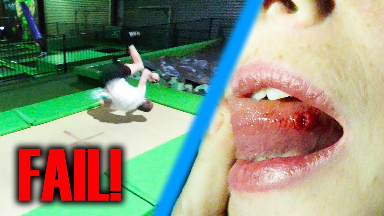 BAD TRAMPOLINE PARK ACCIDENT! *Graphic Warning*