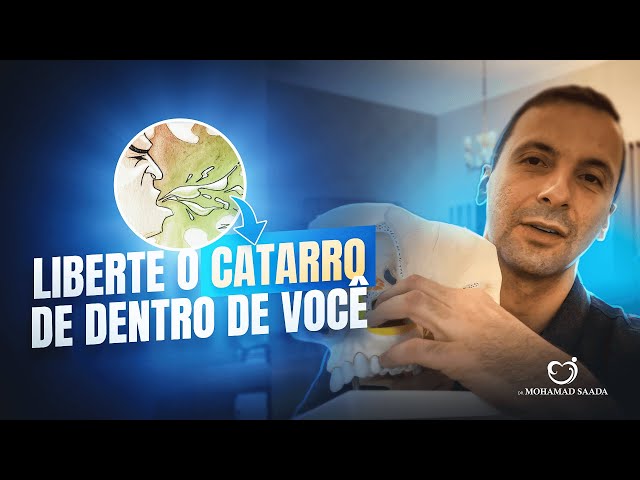 catarro preso na garganta