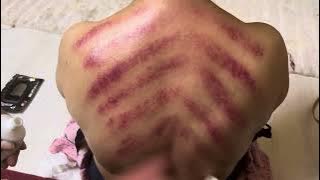 Traditional Indonesian Massage