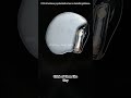 How heart pacemaker works? #sad #doctor #aestheic #eyesurgery
