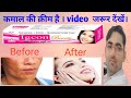 Igcon beauty cream | igcon beauty cream kaise use kare |  igcon cream #drxrabbani #hindi