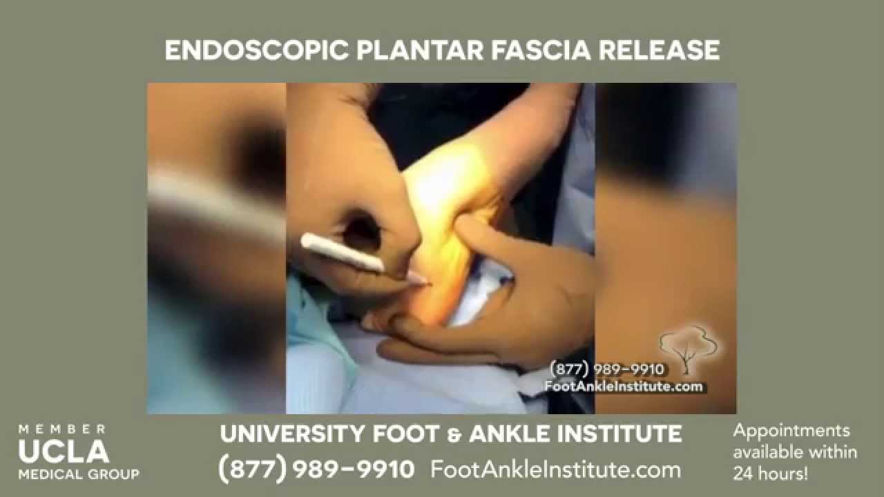 Plantar Fascia Release Surgery Inside the OR with UCLA