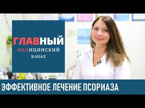 Как лечить псориаз в домашних условиях народными средствами