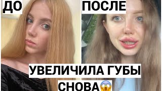 Я УВЕЛИЧИЛА ГУБЫ СНОВА! 2 МЛ В ГУБАХ