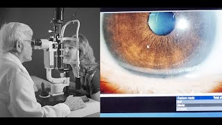 Before Cataract Surgery  What I Wish I Knew (1/4) (4K)