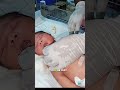 Emergency Baby Care #baby #babies #shorts #babycare #viral #shortsfeed #shortsvideo