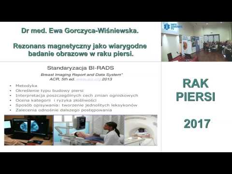 Wideo: Obrazowanie W Raku Piersi: Spektroskopia Rezonansu Magnetycznego